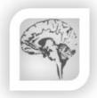 Neurology & Headache Center